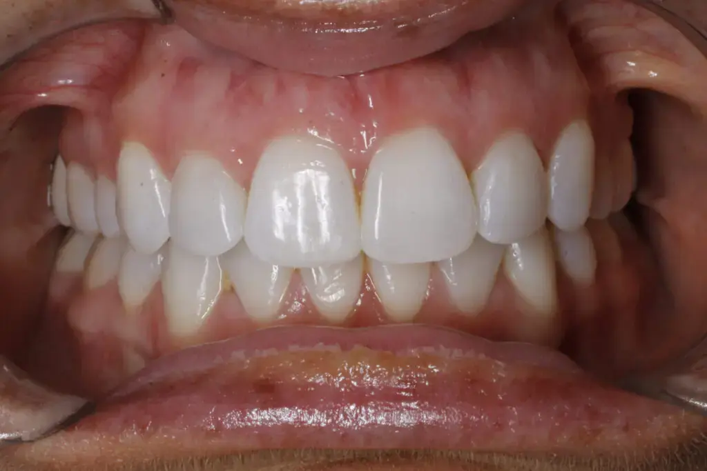 How Do Orthodontists Create a Treatment Plan for Each Patient in Charlotte, Indian Trails, and Monroe, NC?