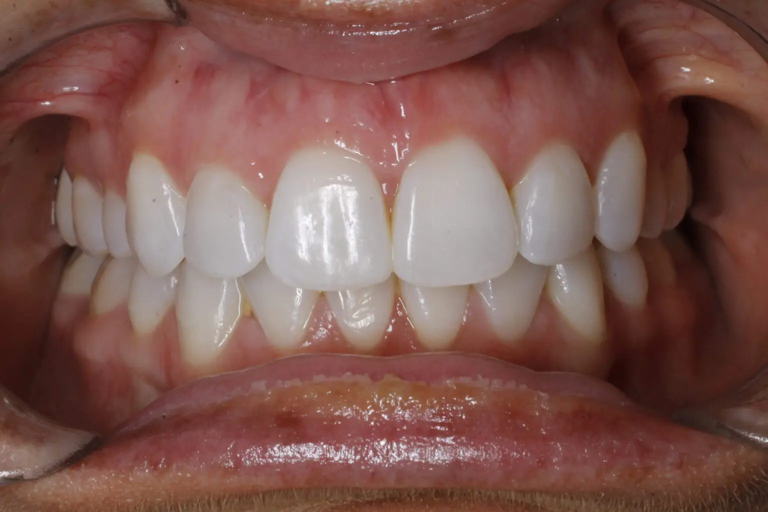 Virtual Ortho Consult