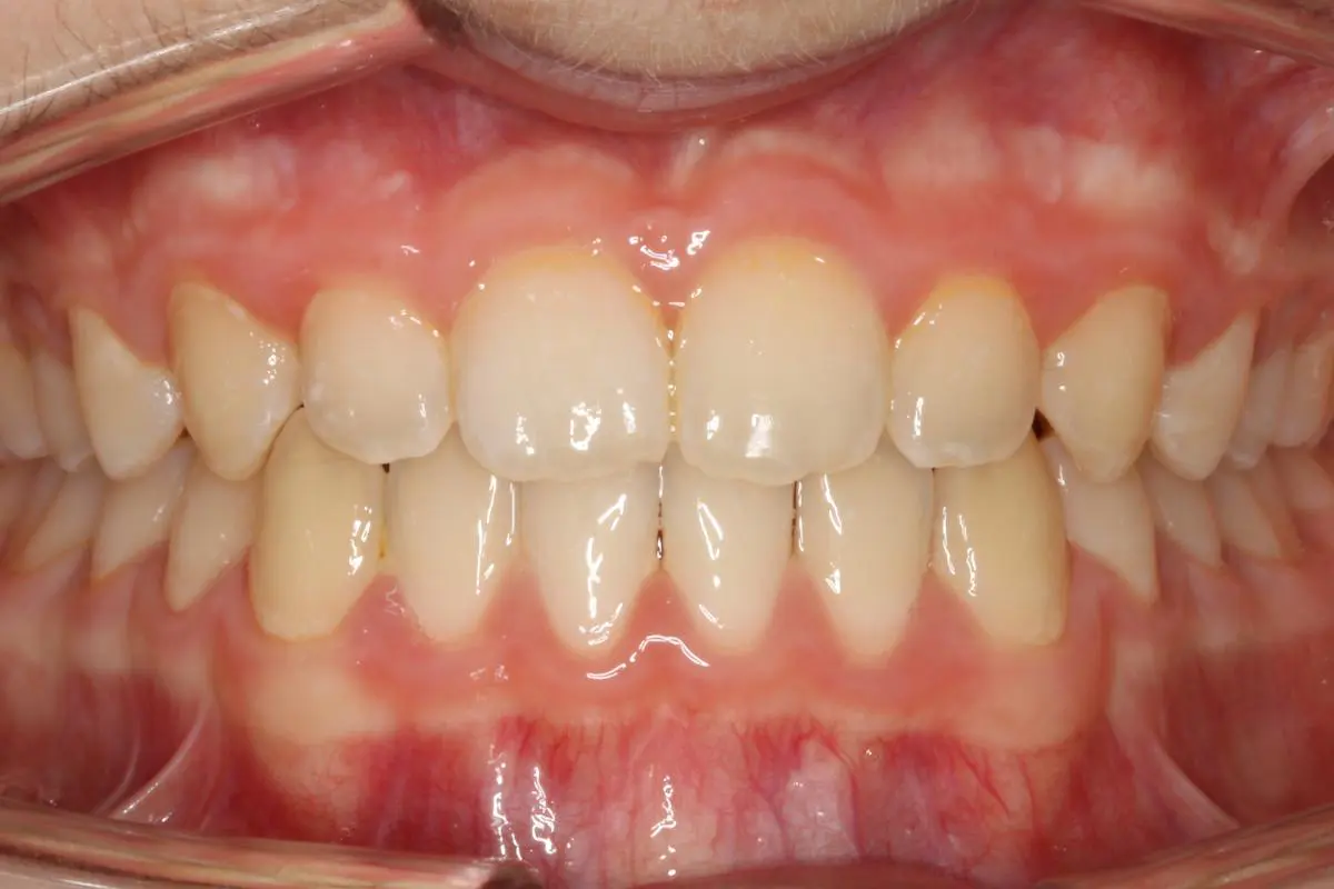 Koerich Orthodontics