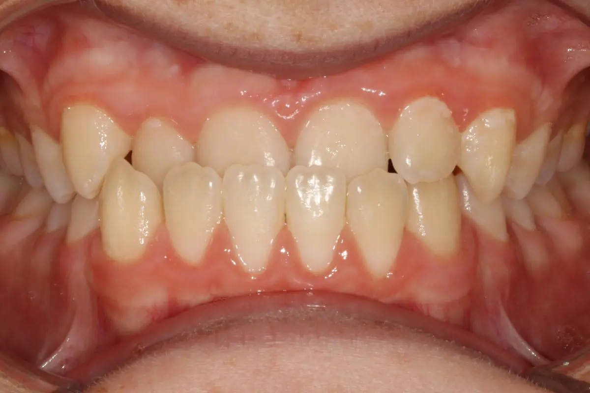 Koerich Orthodontics