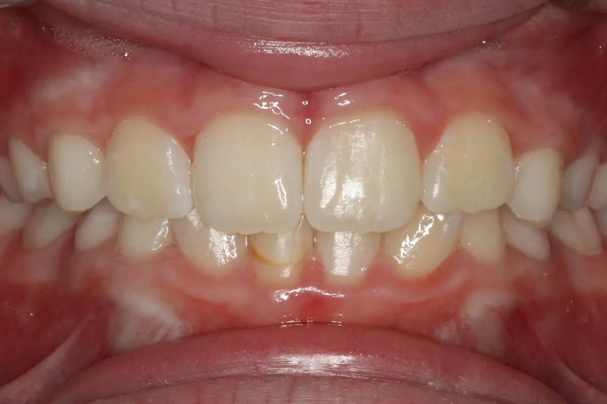 Koerich Orthodontics