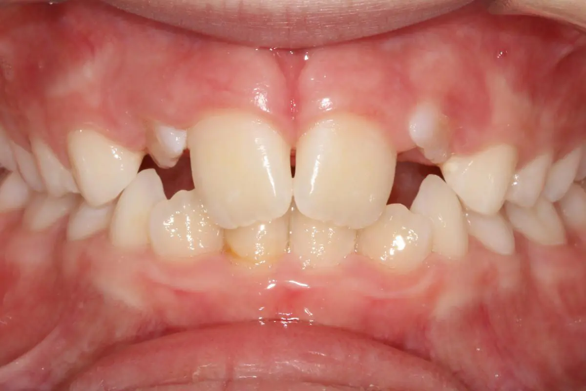Koerich Orthodontics
