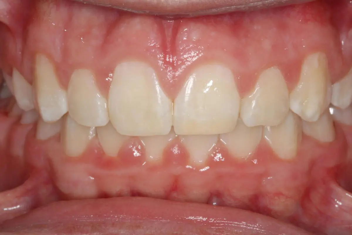Koerich Orthodontics