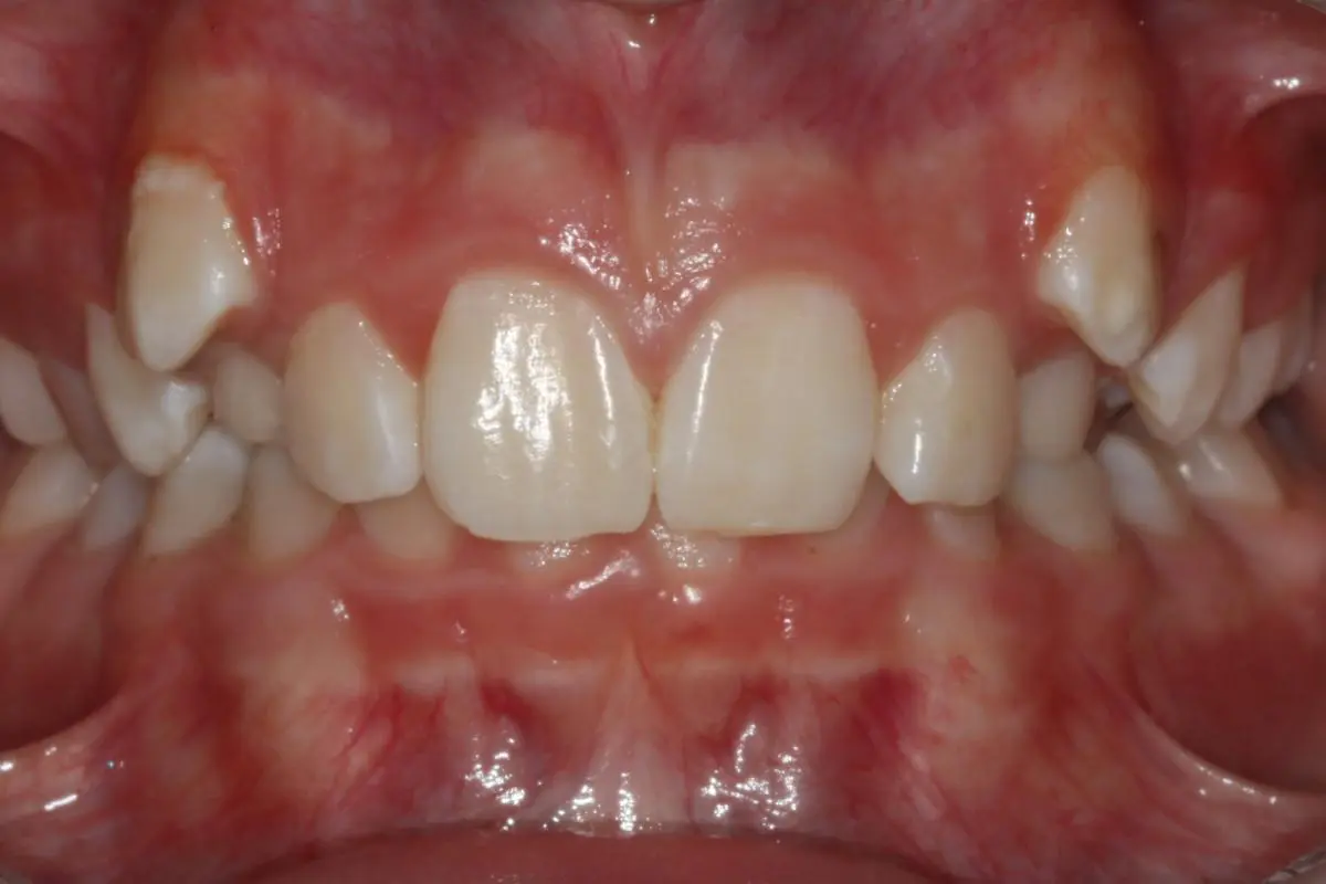 Koerich Orthodontics