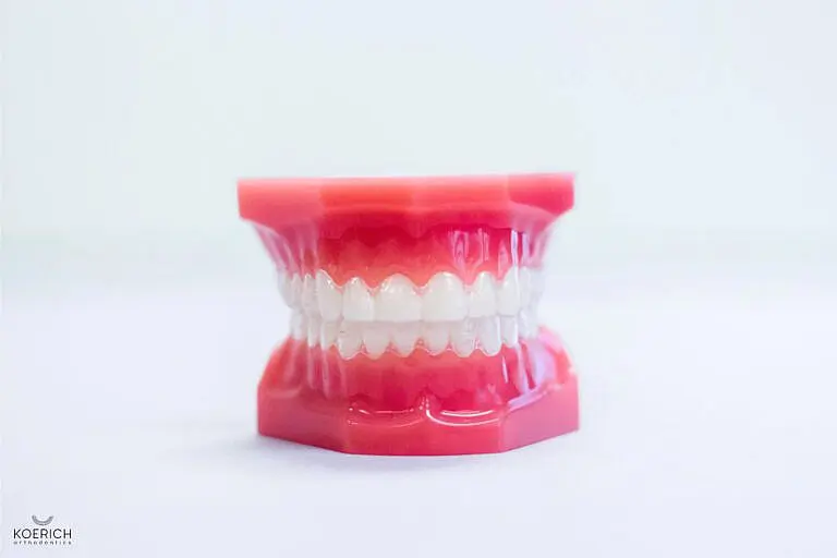 A dental model showcasing a set of upper and lower teeth in occlusion, complete with pink gums, is elegantly positioned against a plain white background—a perfect tool for any orthodontist in Indian Trail NC