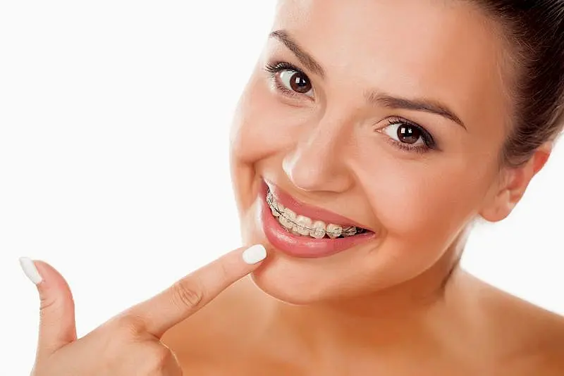 A woman with clear braces is smiling pointing to her braces for representing best braces at Koerich Orthodontics in Indian Trail, NC.