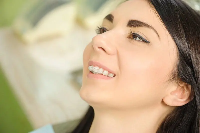 Woman smiling, showcasing her clear braces as they enhance her radiant smile in Indian Trail, NC.