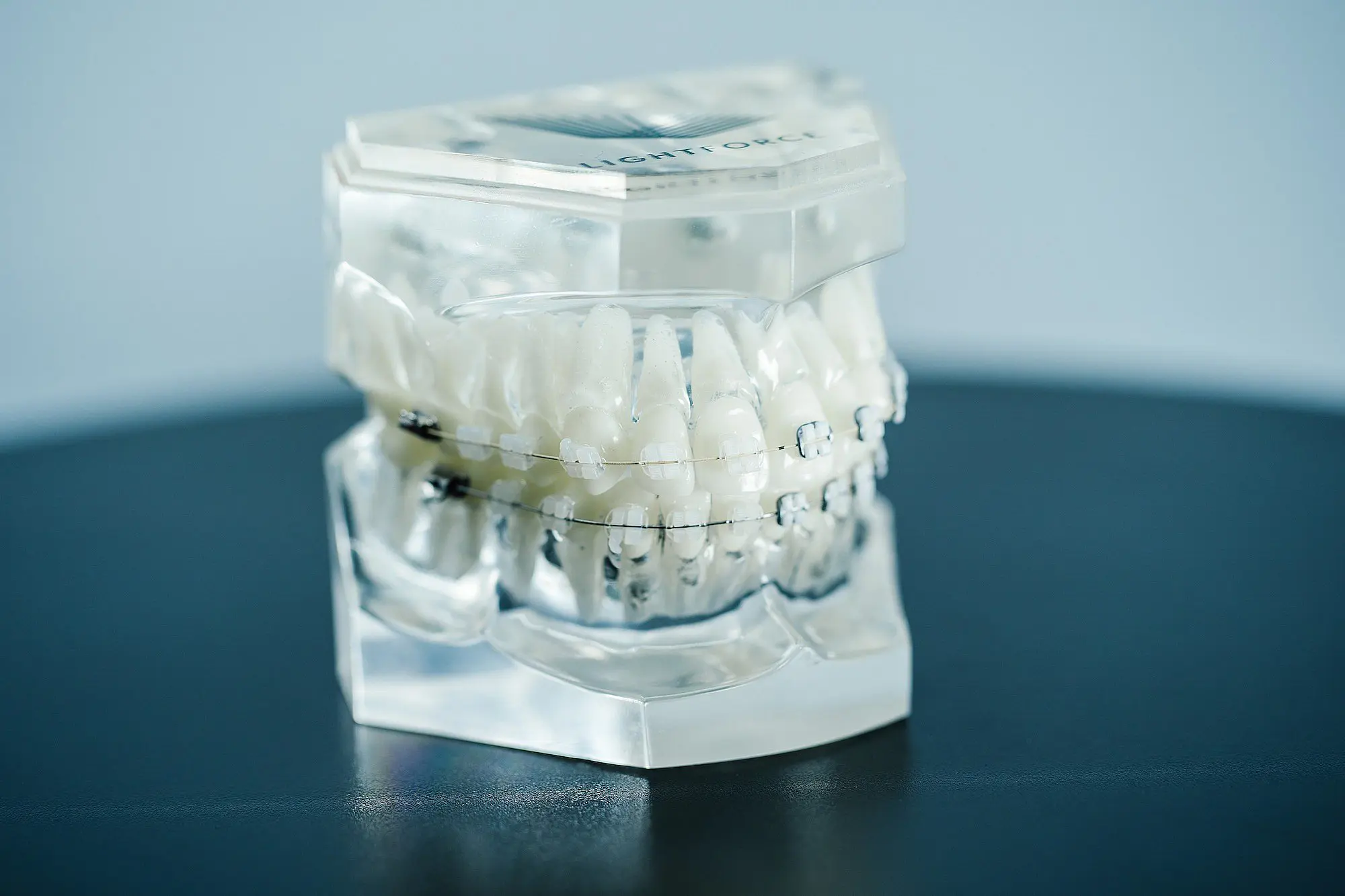 LightForce Clear Braces model showing custom 3D-printed brackets for precise orthodontic treatment in Charlotte, Indian Trail, and Monroe NC.