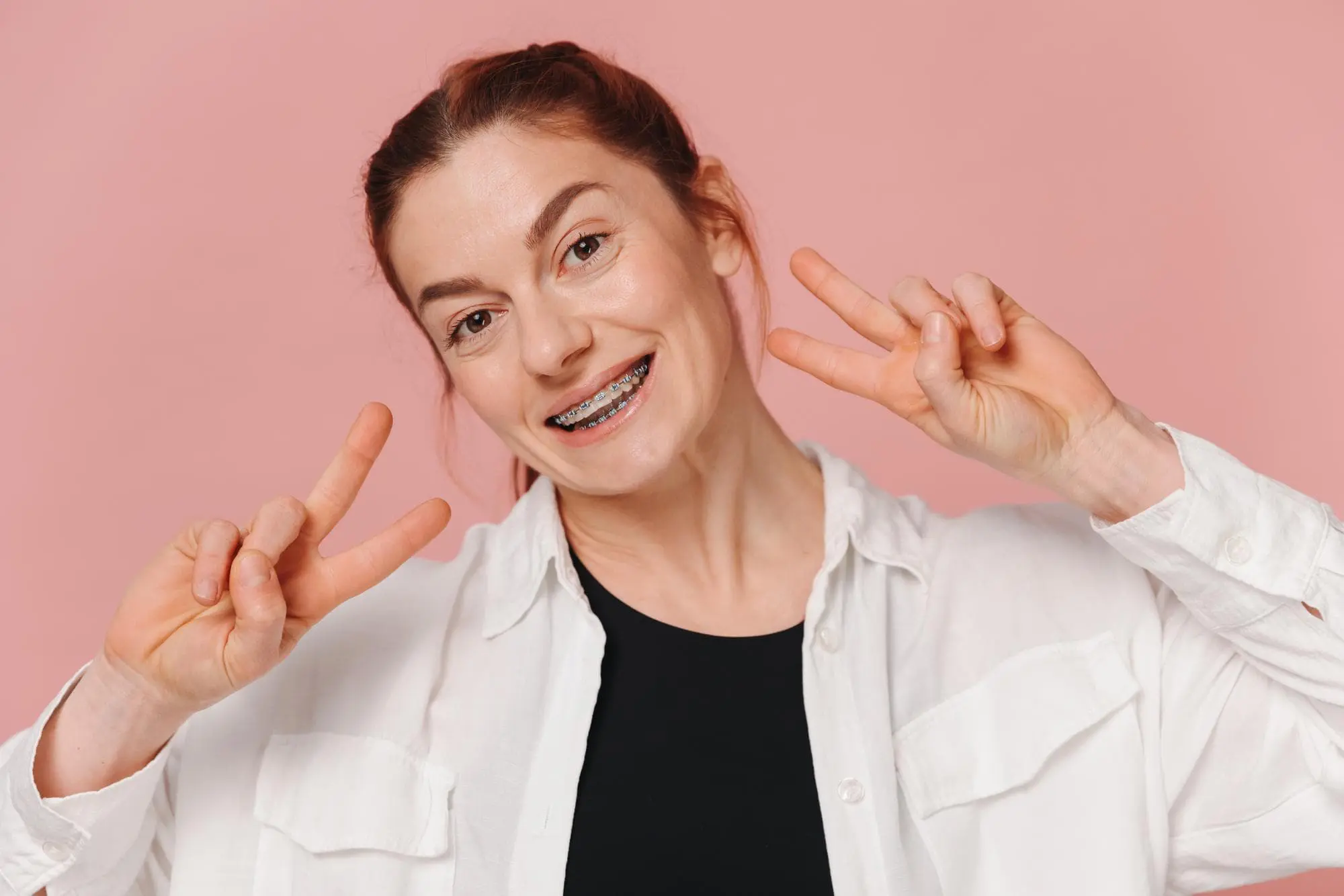 Adult smiling, showing metal braces on teeth and feel benefit adult orthodontics from at Koerich Orthodontics in Charlotte, Indian Trail and Monroe, NC.