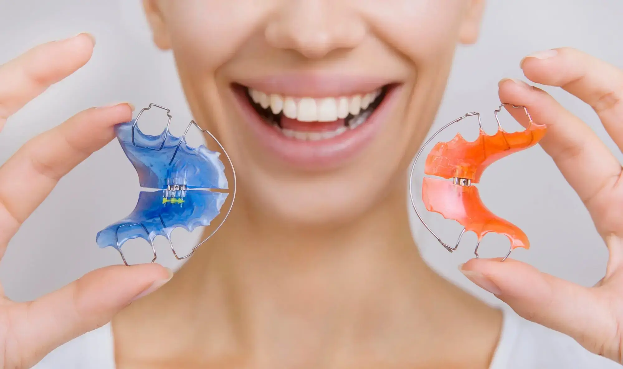 A person smiles while holding two dental teeth retainers—one blue and one red—close to their face, showcasing their results from Koerich Orthodontics in Charlotte, Indian Trail or Monroe, NC.
