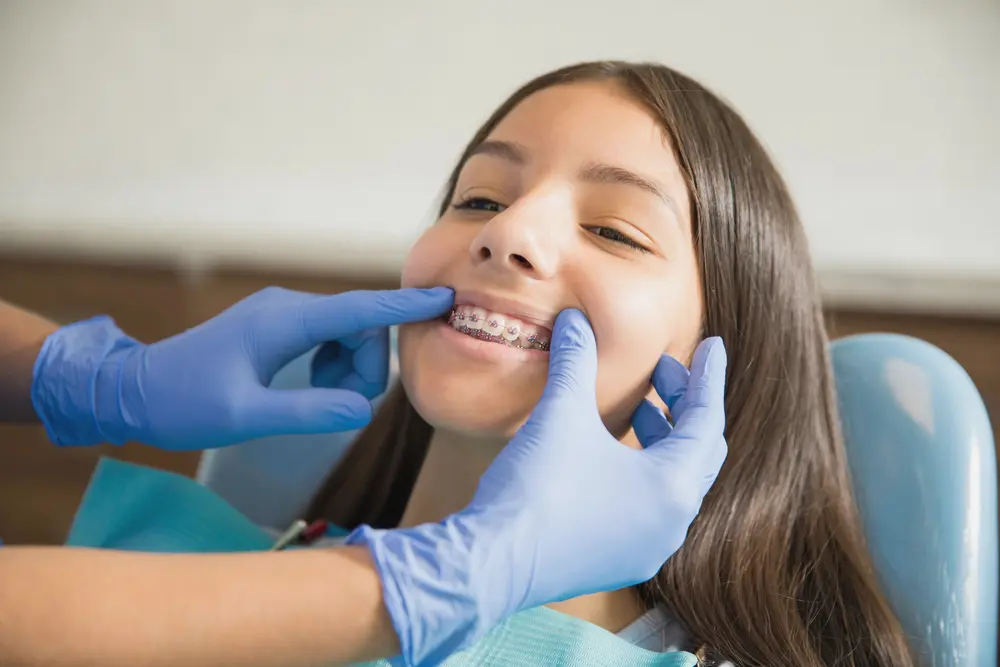 A girl with braces on her teeth at Koerich Orthodontics' braces of overbite in Charlotte, Indian Trail or Monroe, NC.