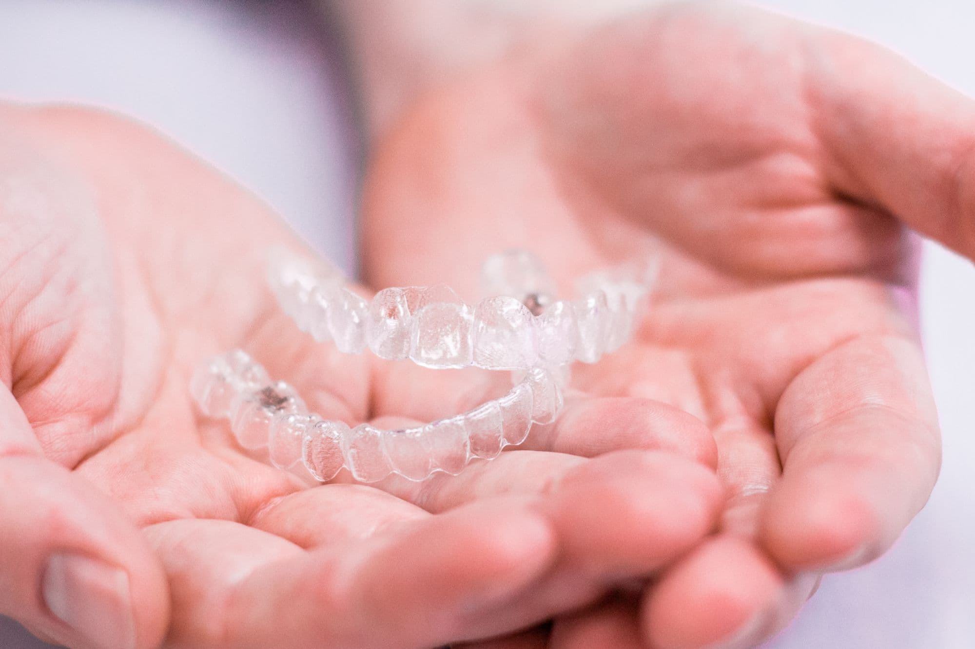 Clear Aligners Charlotte